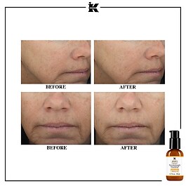 Powerful Strength Line Reducing - Concentrate Serum